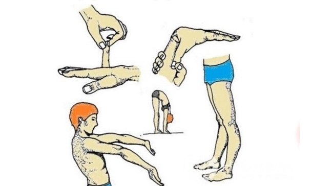 Диспластический синдром